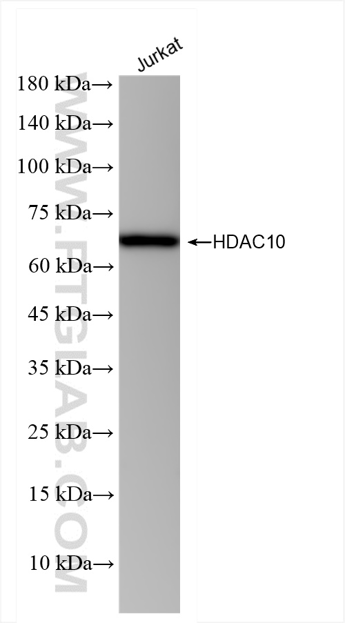 Western Blot (WB) analysis of Jurkat cells using HDAC10 Recombinant antibody (83788-4-RR)