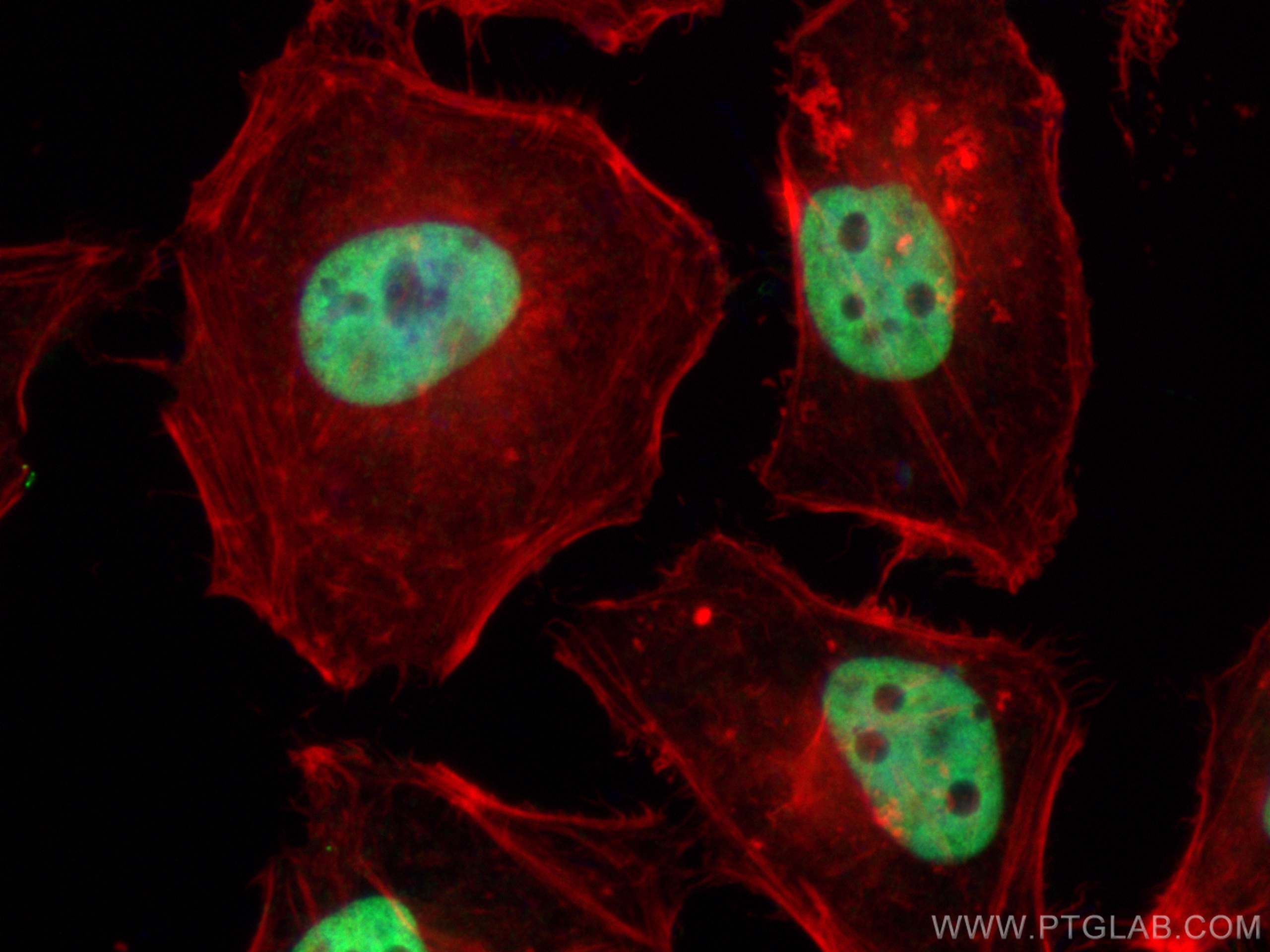 Immunofluorescence (IF) / fluorescent staining of HeLa cells using HDAC2 Polyclonal antibody (12922-3-AP)