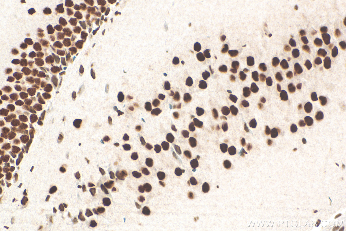 Immunohistochemistry (IHC) staining of mouse brain tissue using HDAC2 Polyclonal antibody (12922-3-AP)