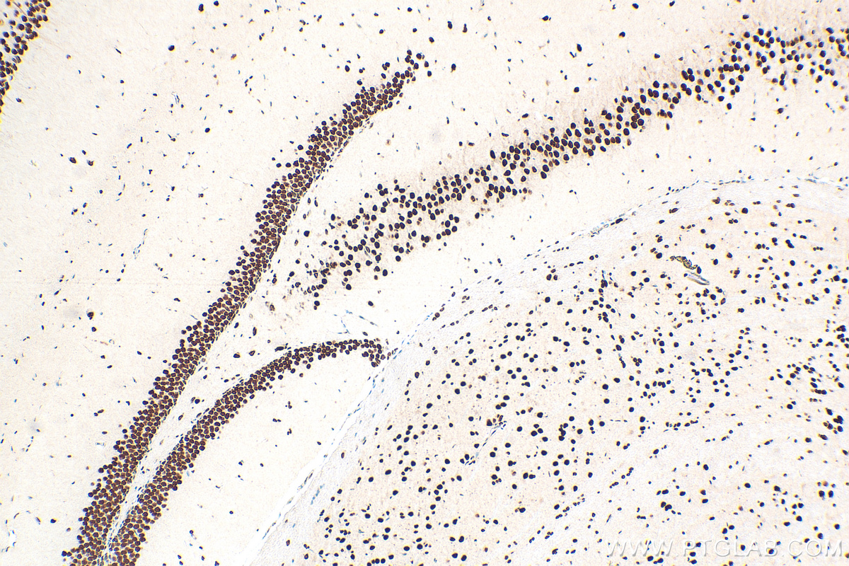 Immunohistochemistry (IHC) staining of mouse brain tissue using HDAC2 Polyclonal antibody (12922-3-AP)