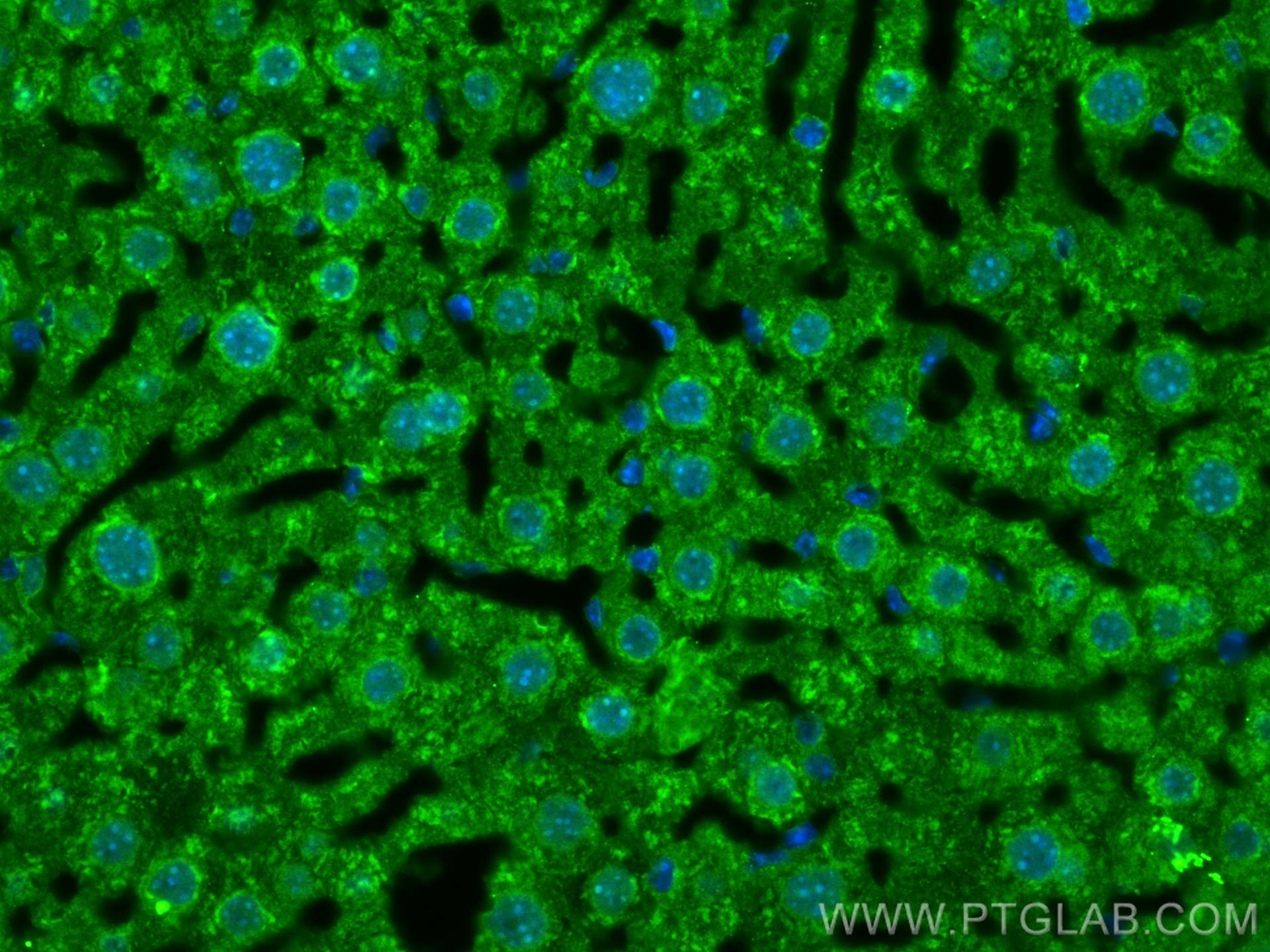 Immunofluorescence (IF) / fluorescent staining of mouse liver tissue using HDAC4 Polyclonal antibody (17449-1-AP)