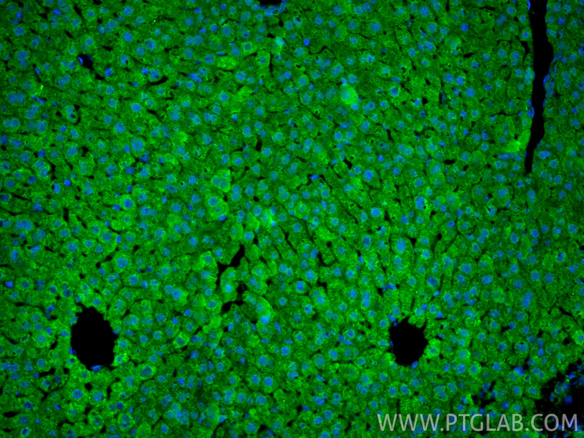 Immunofluorescence (IF) / fluorescent staining of mouse liver tissue using HDAC4 Polyclonal antibody (17449-1-AP)