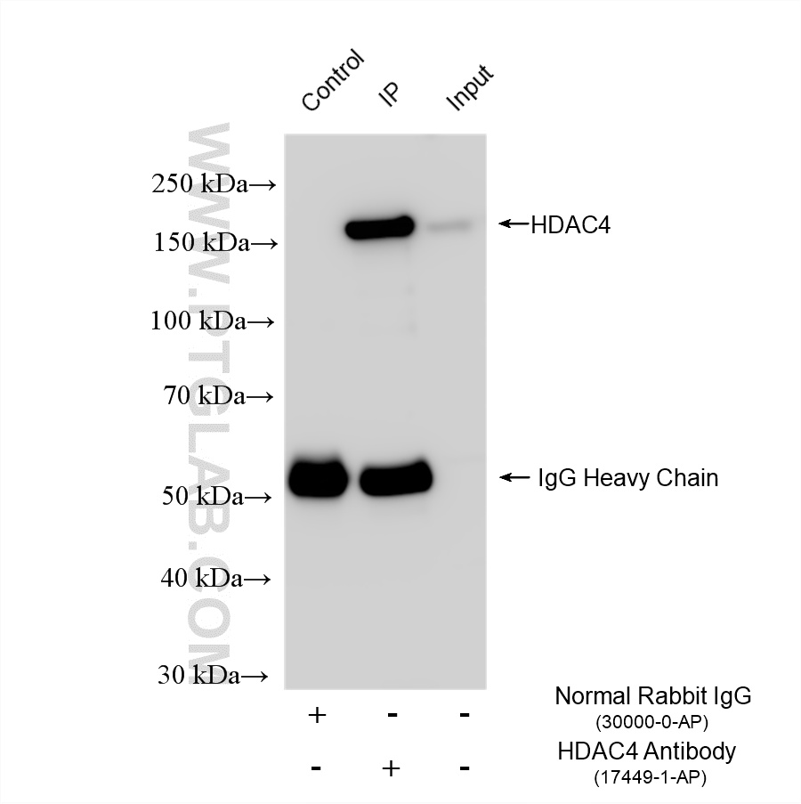 Immunoprecipitation (IP) experiment of Jurkat cells using HDAC4 Polyclonal antibody (17449-1-AP)