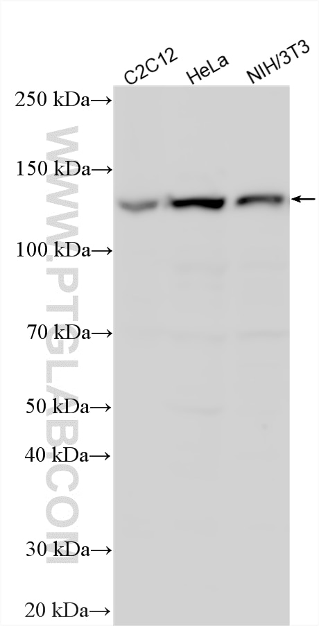 Western Blot (WB) analysis of various lysates using HDAC4 Polyclonal antibody (17449-1-AP)