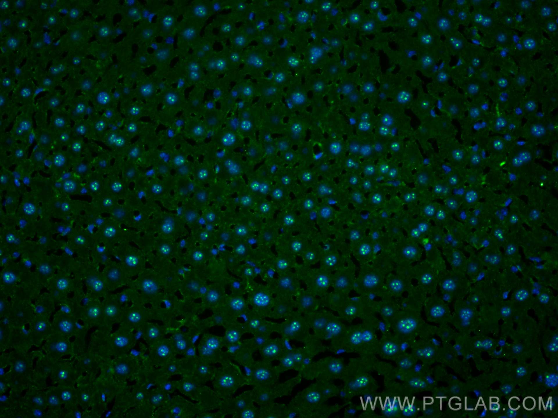 Immunofluorescence (IF) / fluorescent staining of mouse liver tissue using HDAC4 Monoclonal antibody (66838-1-Ig)