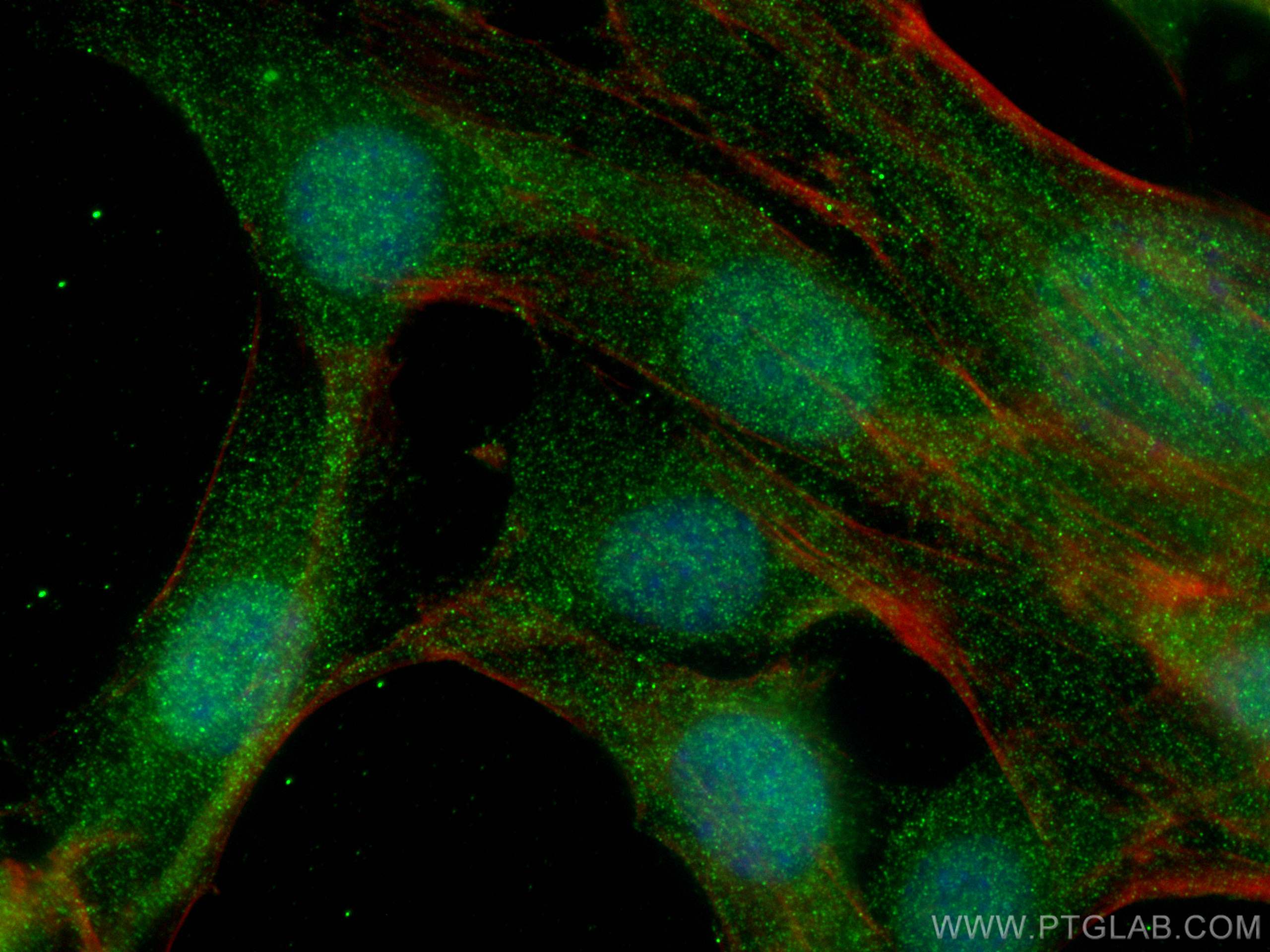 Immunofluorescence (IF) / fluorescent staining of C2C12 cells using HDAC4 Monoclonal antibody (66838-1-Ig)