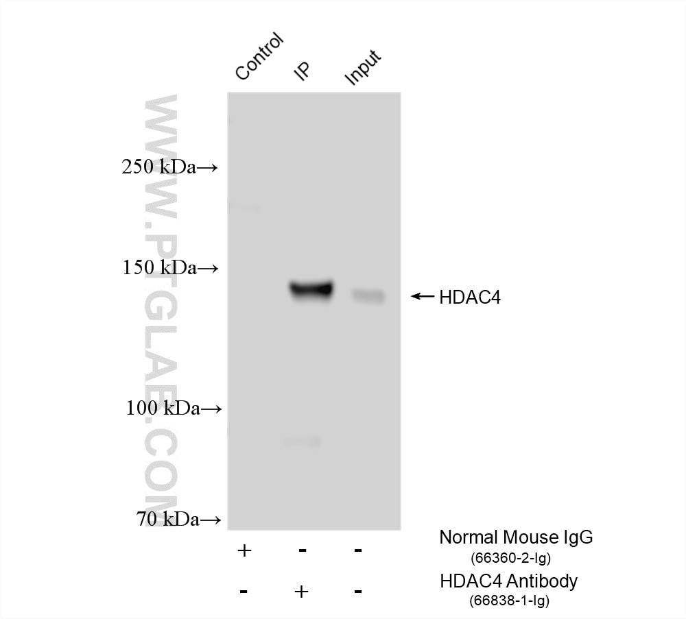 Immunoprecipitation (IP) experiment of Jurkat cells using HDAC4 Monoclonal antibody (66838-1-Ig)