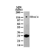 HDAC4 antibody (pAb) tested by Western blot. Detection of HDAC4 by Western blot. The analysis was performed using 293 nuclear extract and HDAC4 pAb. A protein band of approximate molecular weight of 140 kDa was detected.