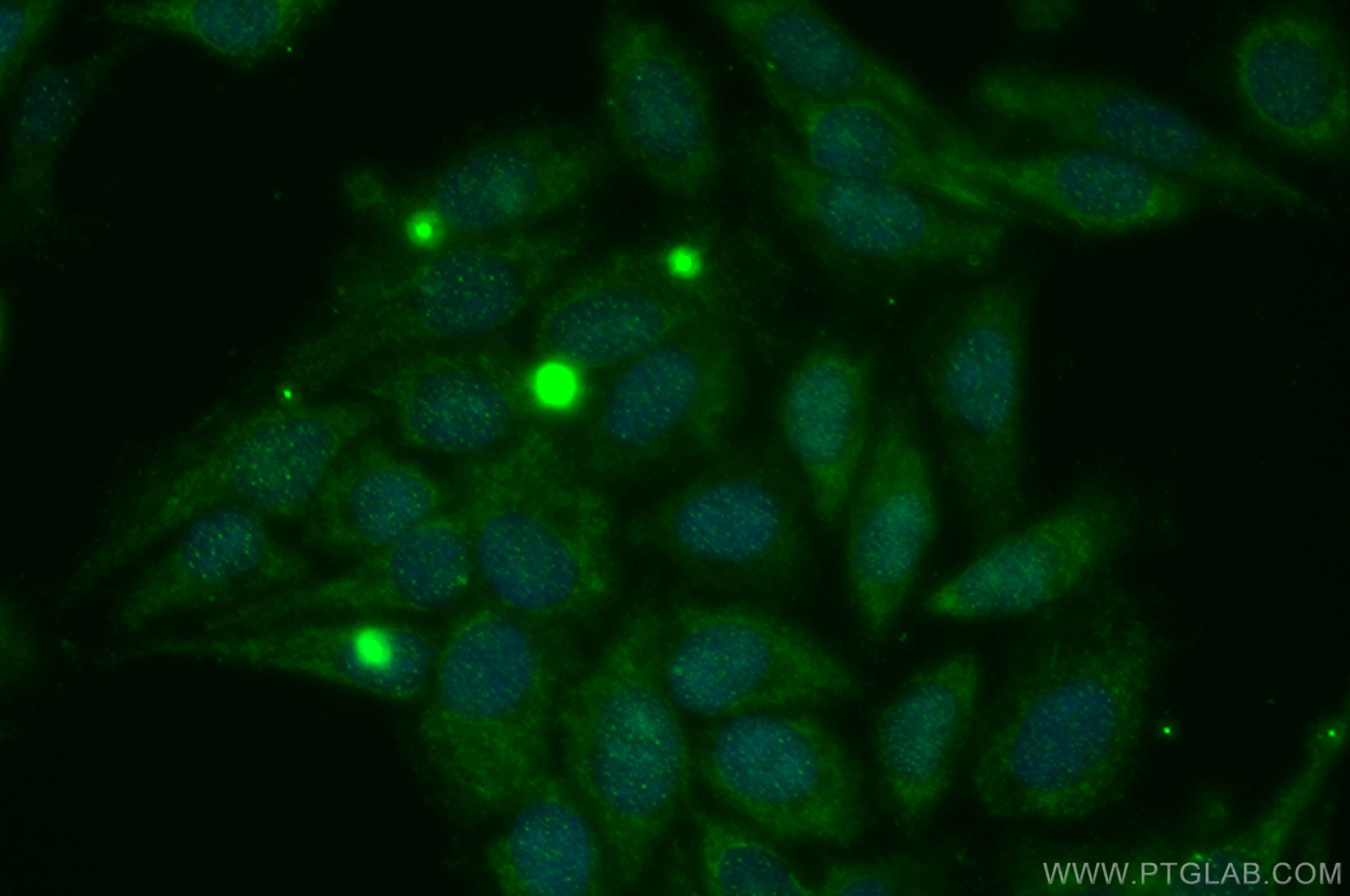 HDAC5-specific