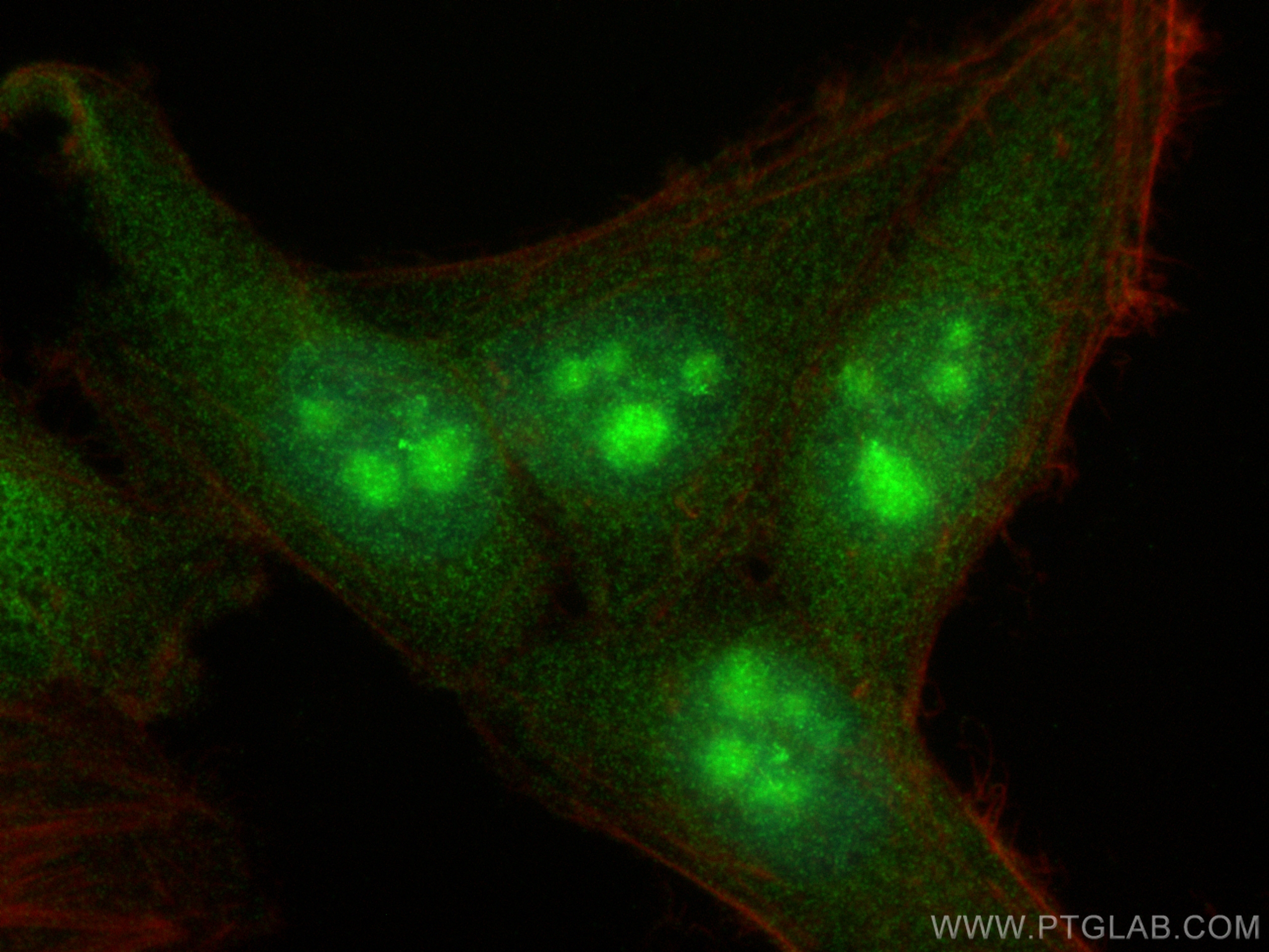 Immunofluorescence (IF) / fluorescent staining of HepG2 cells using HDAC5-specific Polyclonal antibody (16166-1-AP)