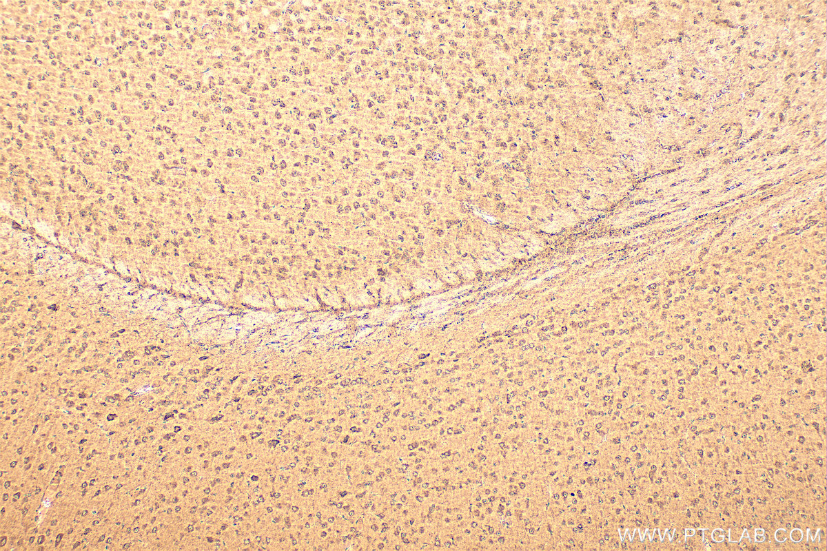 Immunohistochemistry (IHC) staining of mouse brain tissue using HDAC6 Polyclonal antibody (12834-1-AP)