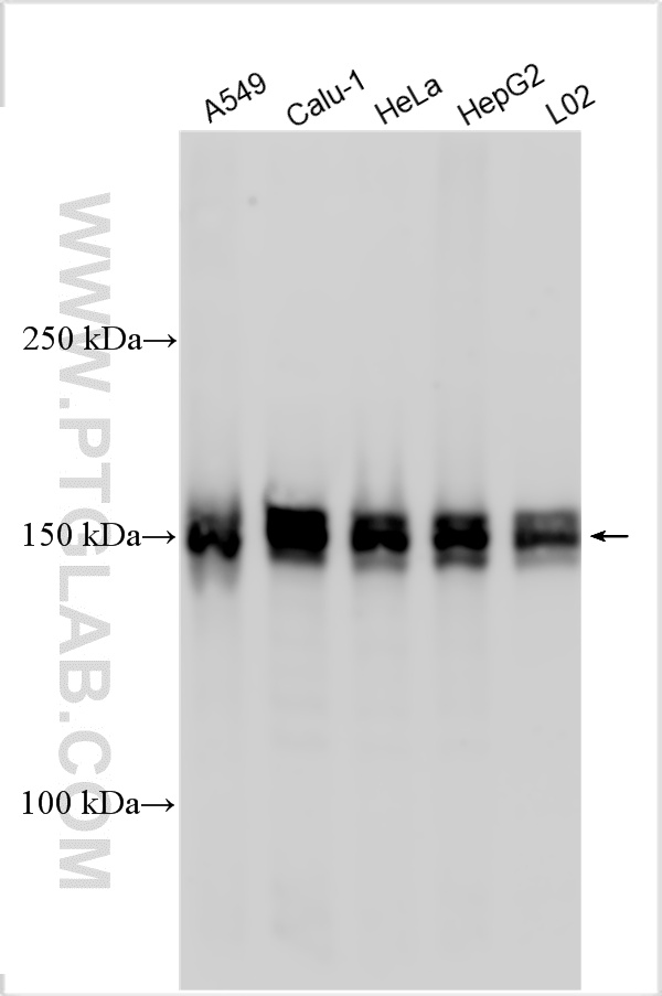 Western Blot (WB) analysis of various lysates using HDAC6 Polyclonal antibody (12834-1-AP)
