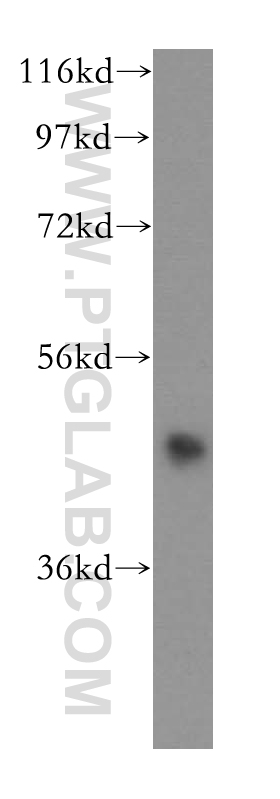 Western Blot (WB) analysis of HeLa cells using HDAC8 Polyclonal antibody (17548-1-AP)