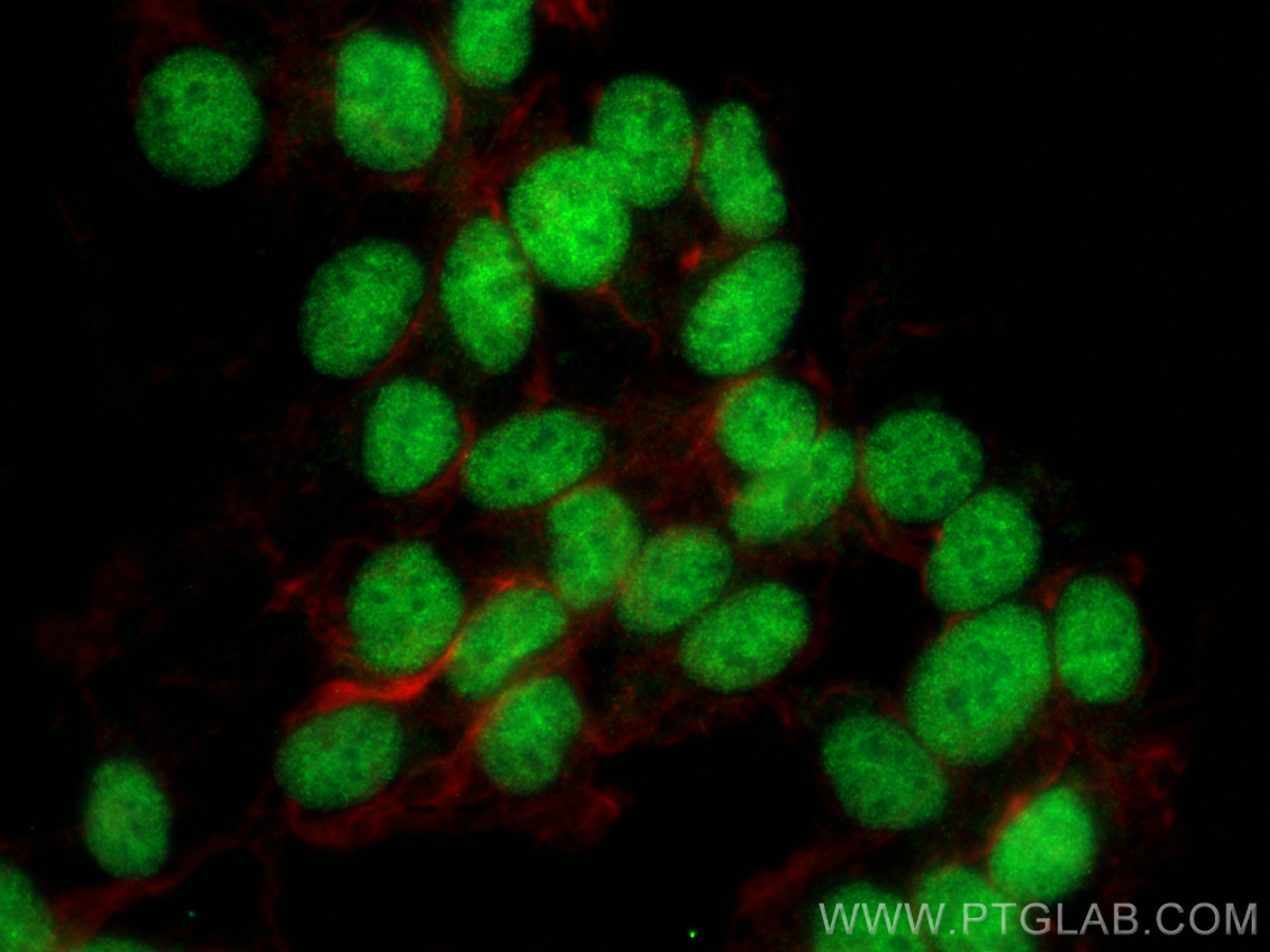 Immunofluorescence (IF) / fluorescent staining of SH-SY5Y cells using HDAC9 Polyclonal antibody (23328-1-AP)