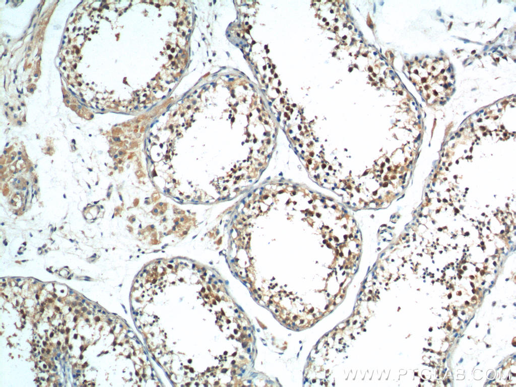 Immunohistochemistry (IHC) staining of human testis tissue using HDAC9 Polyclonal antibody (23328-1-AP)