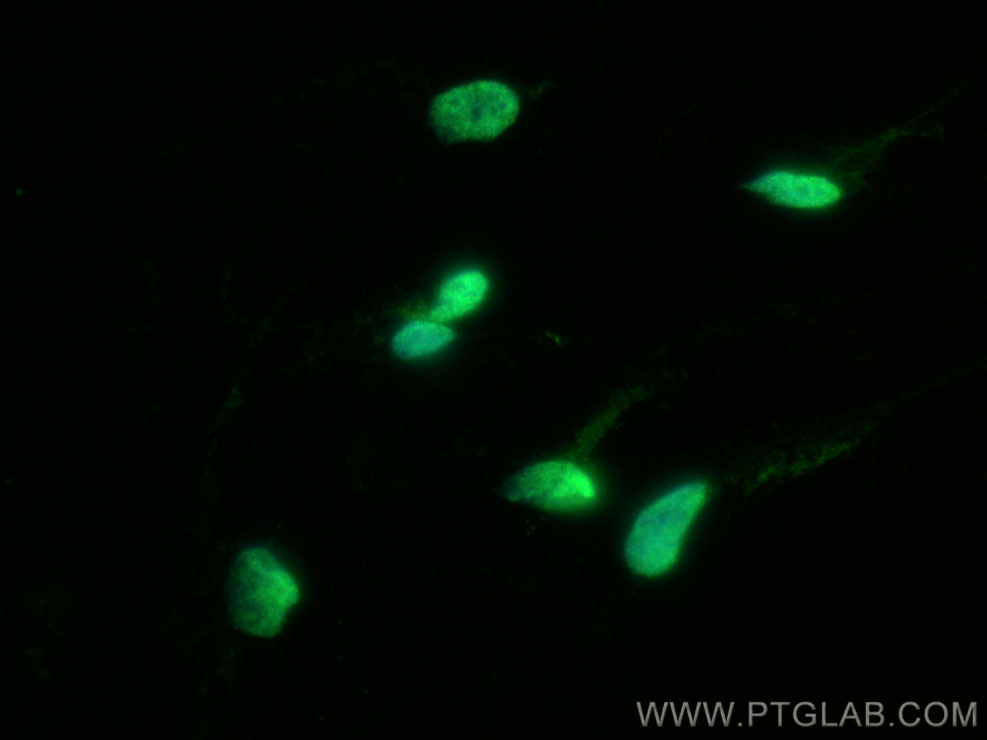 Immunofluorescence (IF) / fluorescent staining of SH-SY5Y cells using HDAC9 Polyclonal antibody (28334-1-AP)