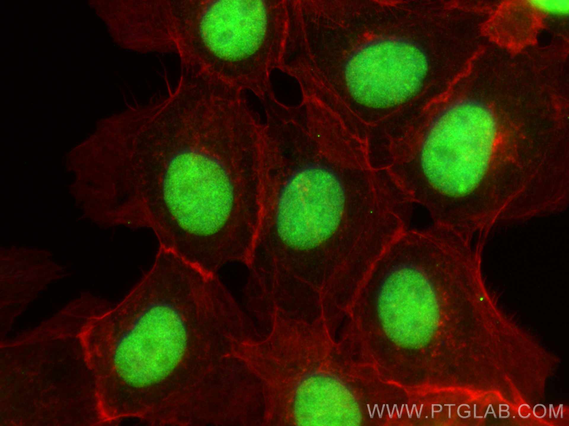 Immunofluorescence (IF) / fluorescent staining of A431 cells using HDGF2 Polyclonal antibody (15134-1-AP)