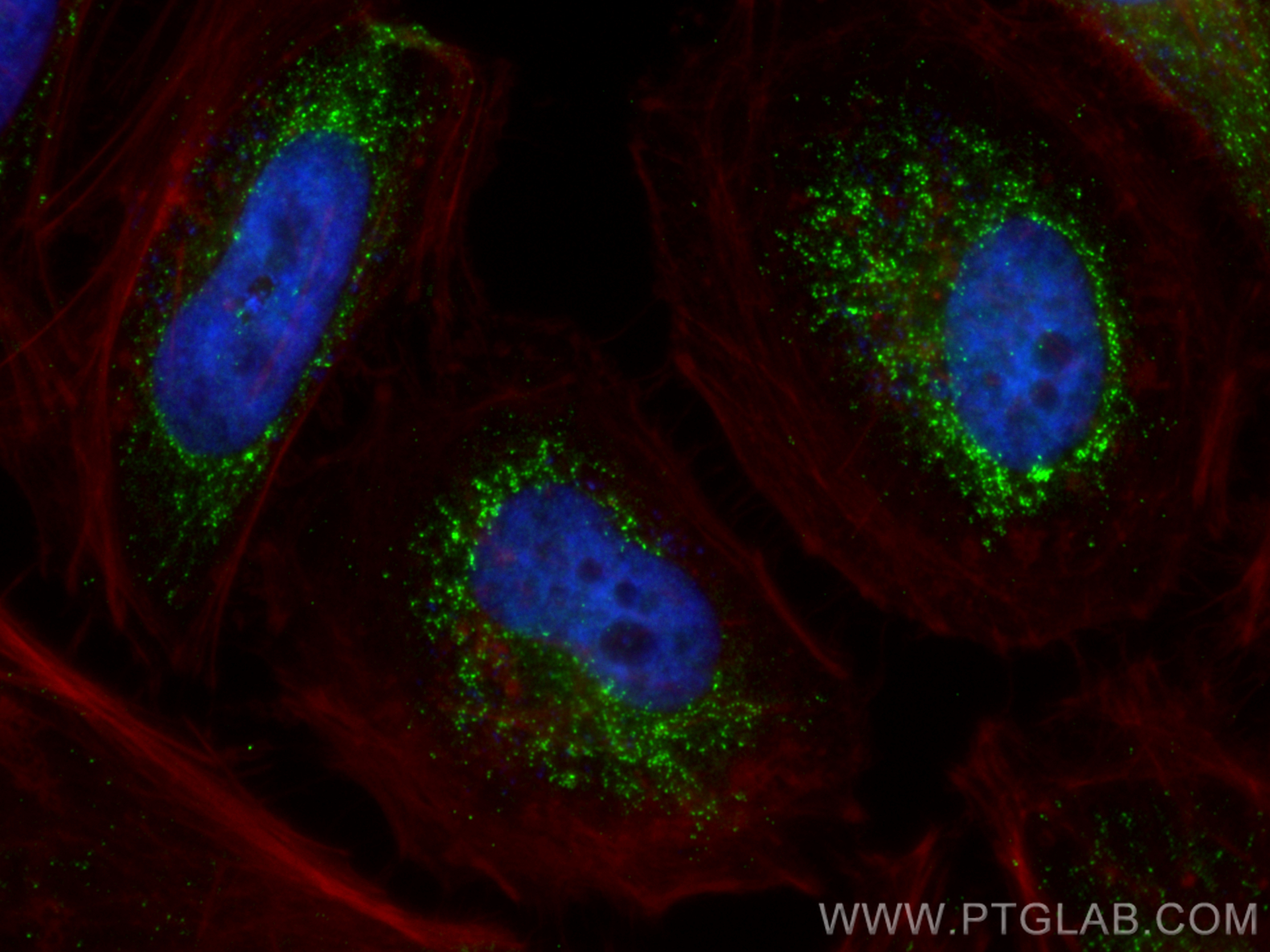 Immunofluorescence (IF) / fluorescent staining of HeLa cells using HDHD2 Polyclonal antibody (26147-1-AP)