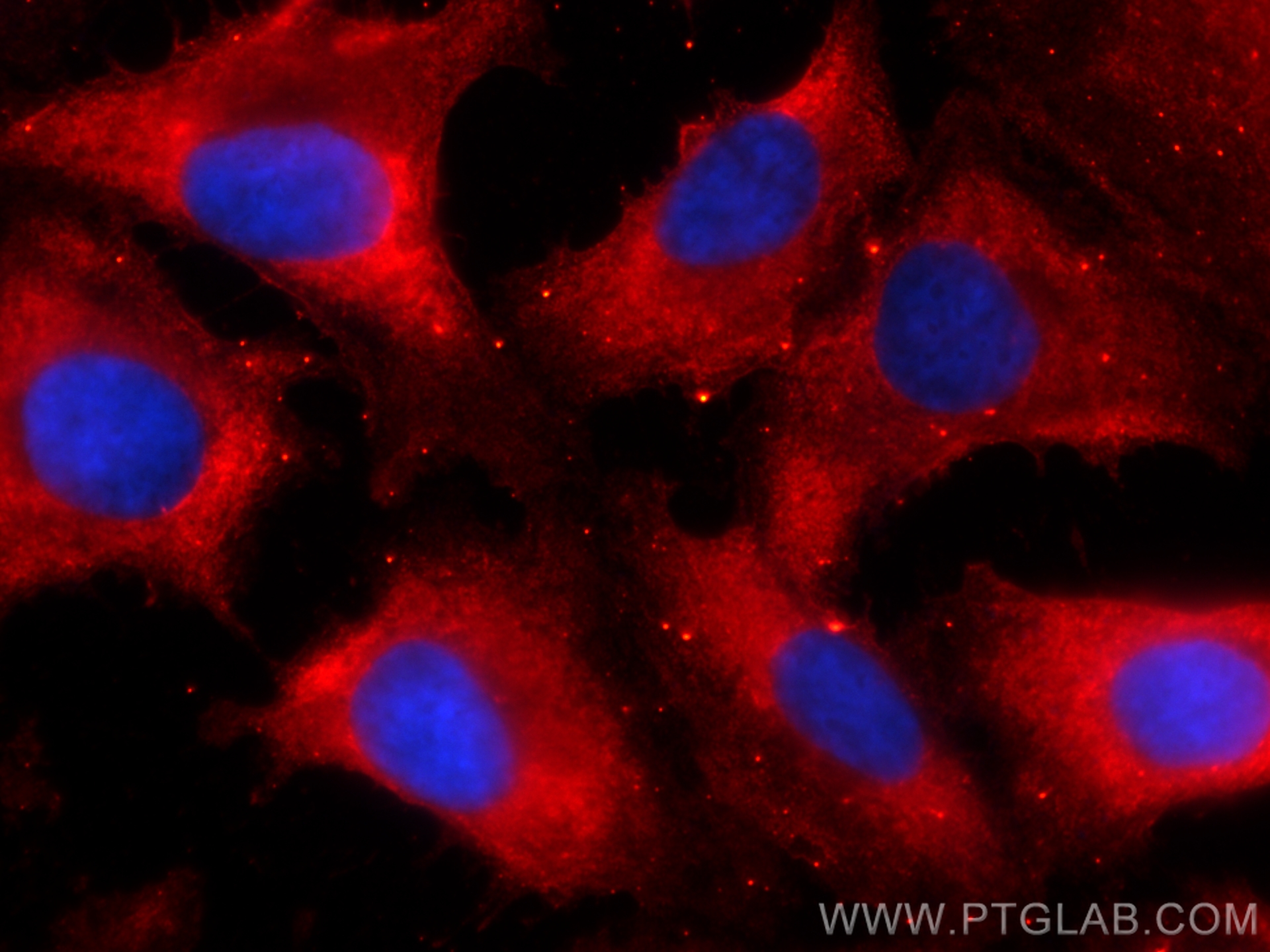 Immunofluorescence (IF) / fluorescent staining of SKOV-3 cells using CoraLite®594-conjugated HE4 Monoclonal antibody (CL594-66557)