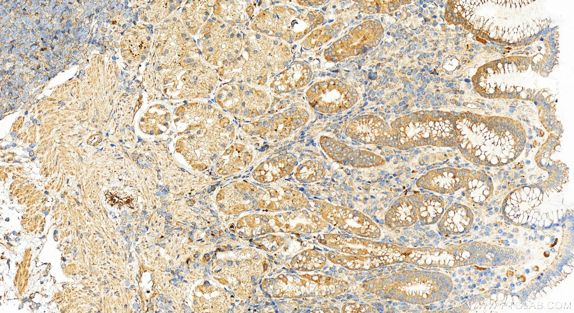 Immunohistochemistry (IHC) staining of human stomach tissue using HEATR2 Polyclonal antibody (24578-1-AP)