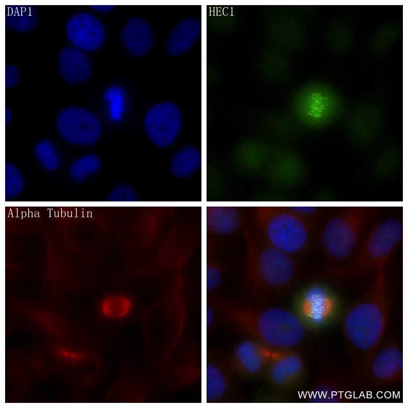 Immunofluorescence (IF) / fluorescent staining of HepG2 cells using HEC1/HEC/NDC80 Recombinant antibody (83859-1-RR)