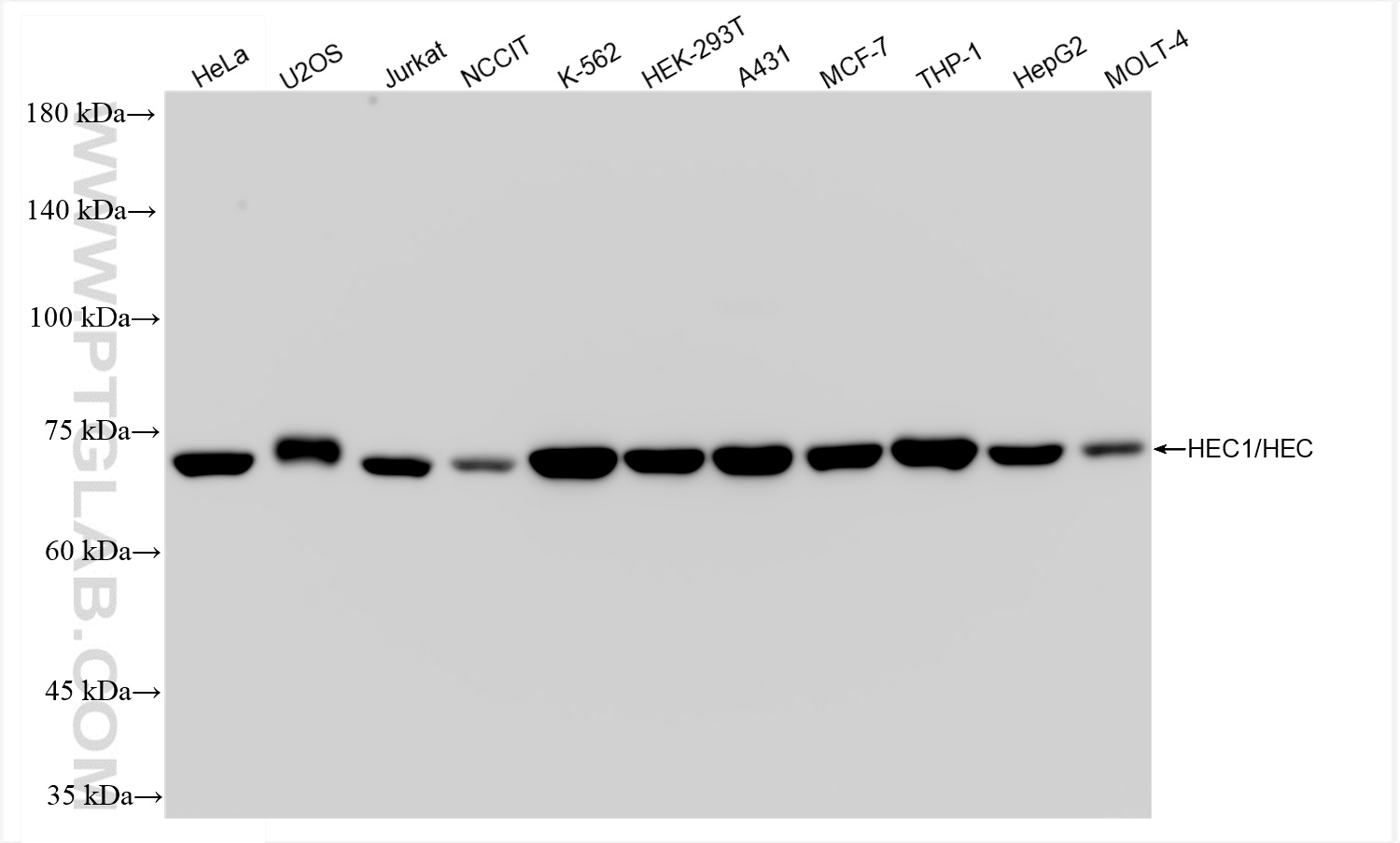 Western Blot (WB) analysis of various lysates using HEC1/HEC/NDC80 Recombinant antibody (83859-1-RR)