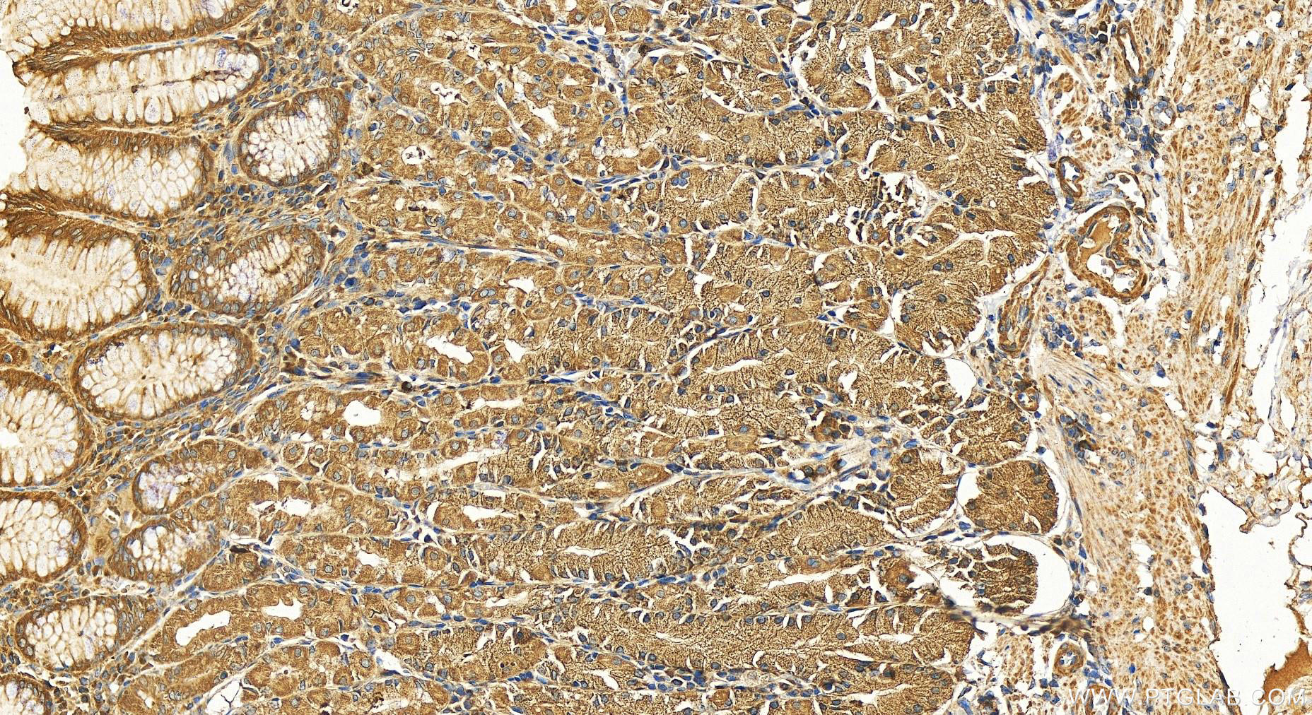 Immunohistochemistry (IHC) staining of human stomach tissue using HECTD3 Polyclonal antibody (11487-1-AP)