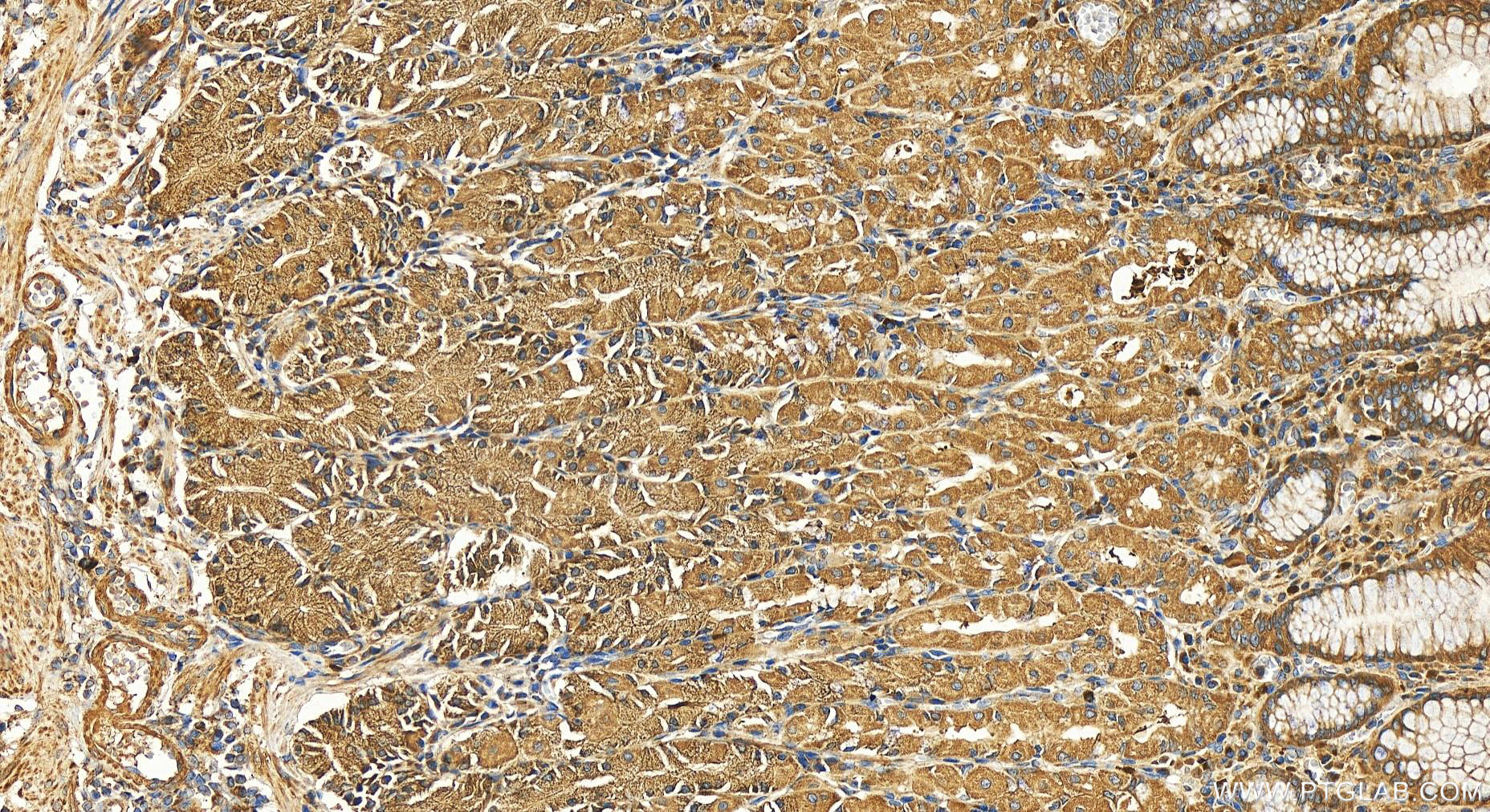 Immunohistochemistry (IHC) staining of human stomach tissue using HECTD3 Polyclonal antibody (11487-1-AP)