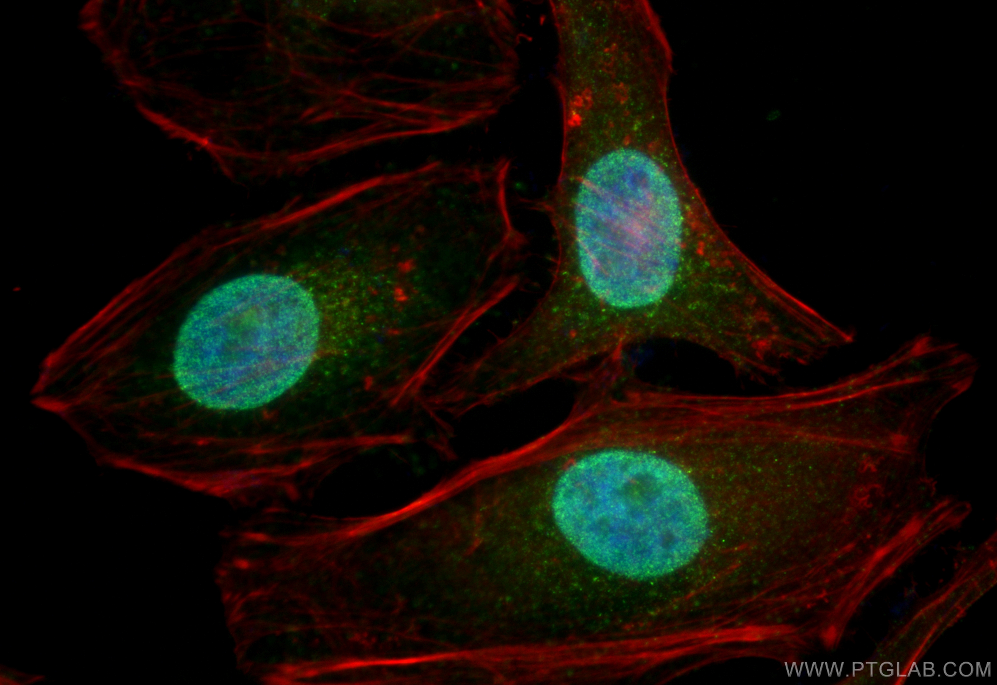 Immunofluorescence (IF) / fluorescent staining of HeLa cells using HELB Polyclonal antibody (24700-1-AP)