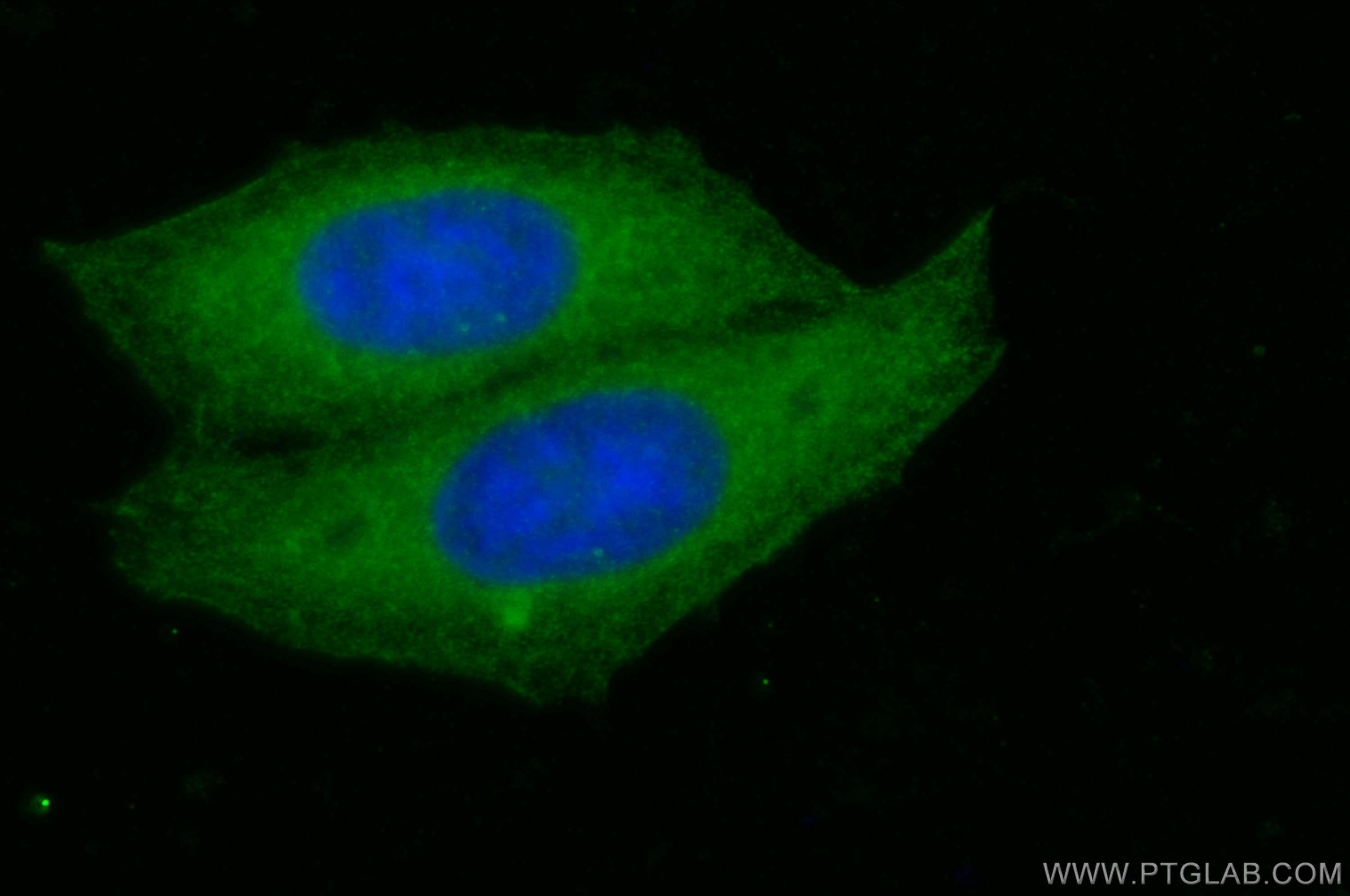 Immunofluorescence (IF) / fluorescent staining of HepG2 cells using HELZ Polyclonal antibody (26635-1-AP)