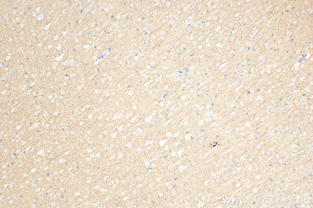 Immunohistochemistry (IHC) staining of rat brain tissue using HEPACAM Polyclonal antibody (18177-1-AP)