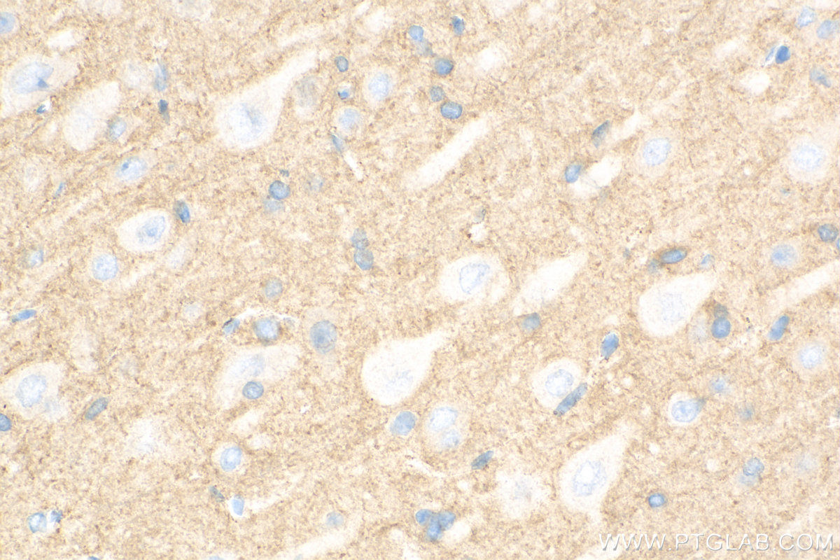 Immunohistochemistry (IHC) staining of rat brain tissue using HEPACAM Polyclonal antibody (18177-1-AP)