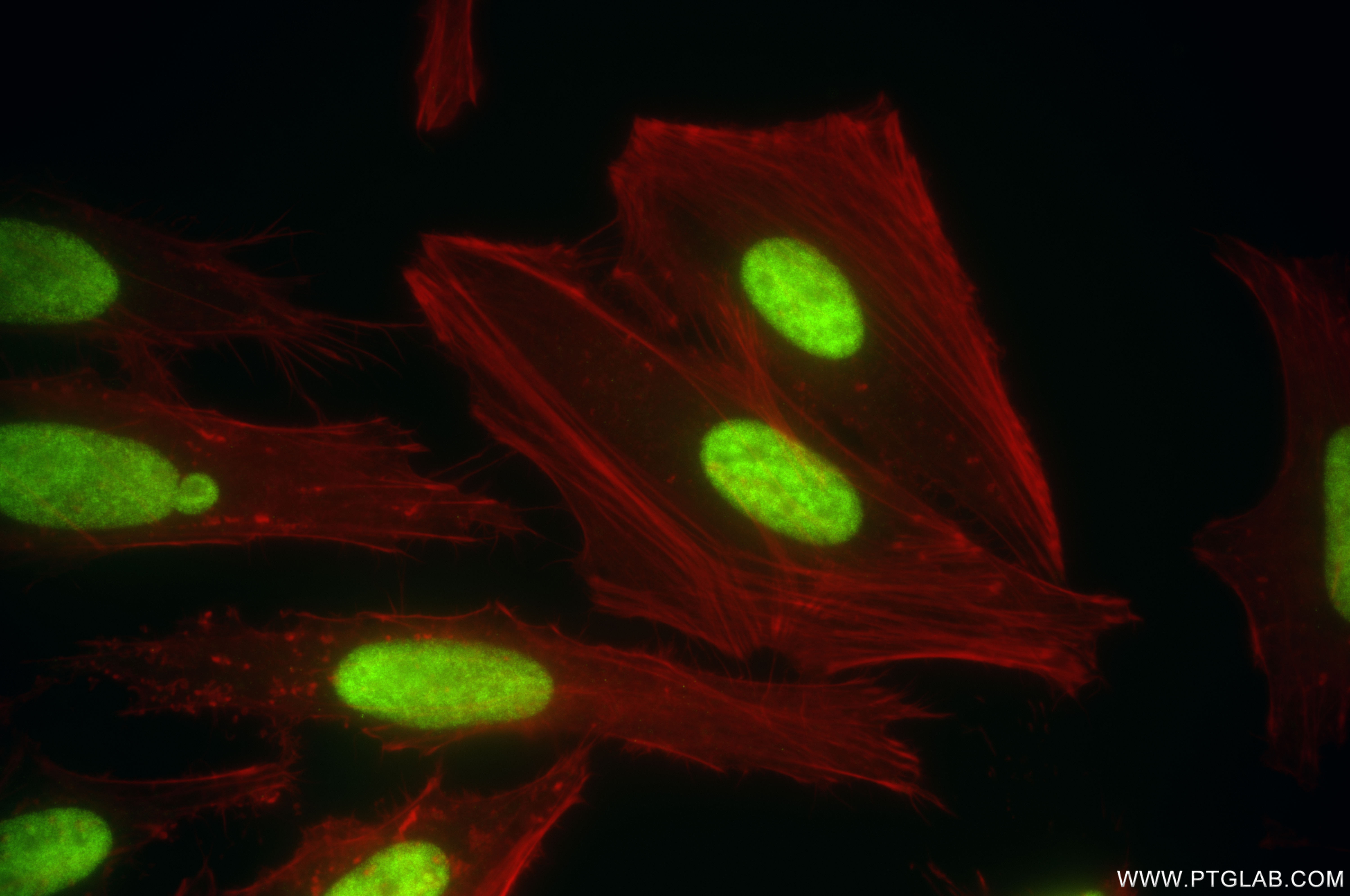 Immunofluorescence (IF) / fluorescent staining of HeLa cells using HEXIM1 Recombinant antibody (85028-1-RR)