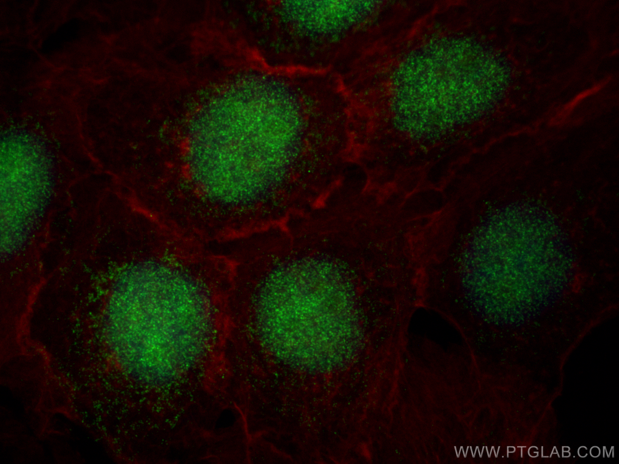 Immunofluorescence (IF) / fluorescent staining of A431 cells using HEXIM2 Polyclonal antibody (16598-1-AP)