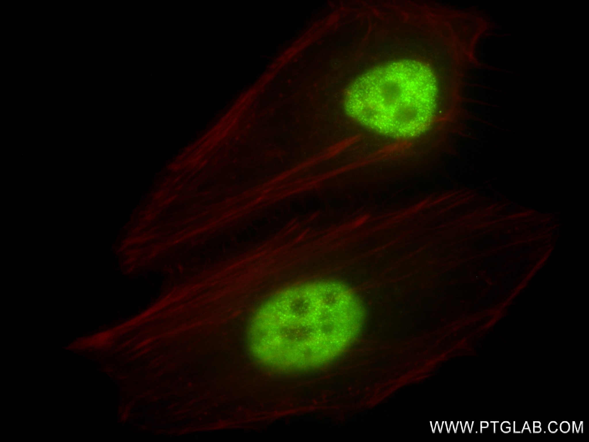 Immunofluorescence (IF) / fluorescent staining of HeLa cells using HEY2 Recombinant antibody (83501-7-RR)