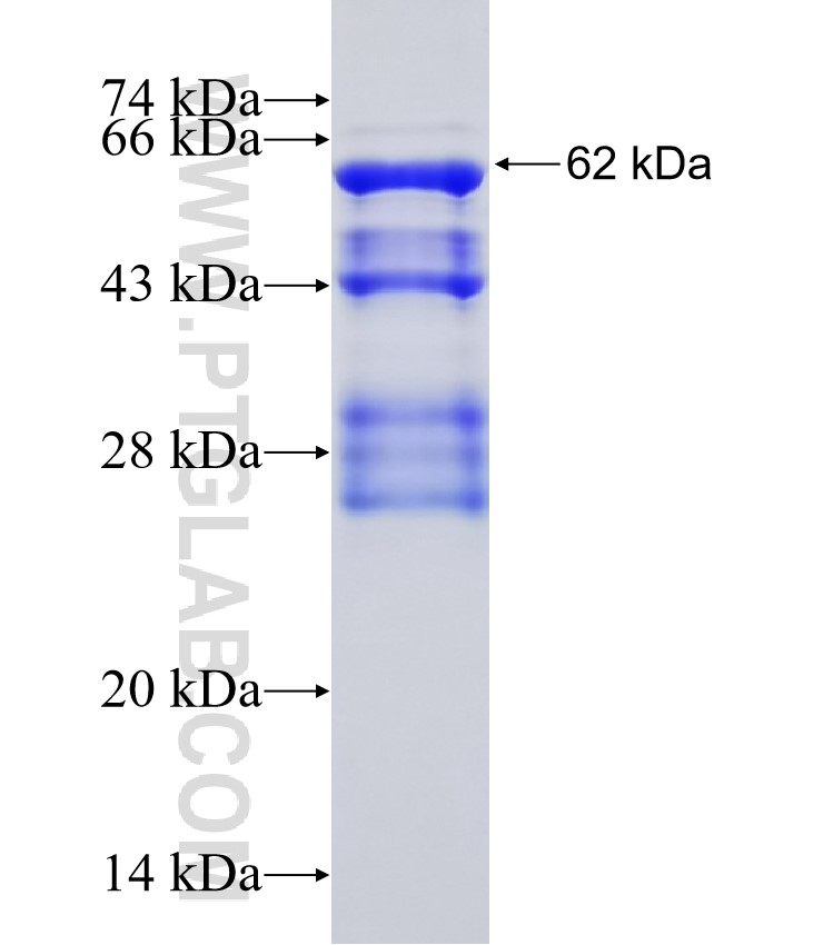 HEY2 fusion protein Ag30988 SDS-PAGE
