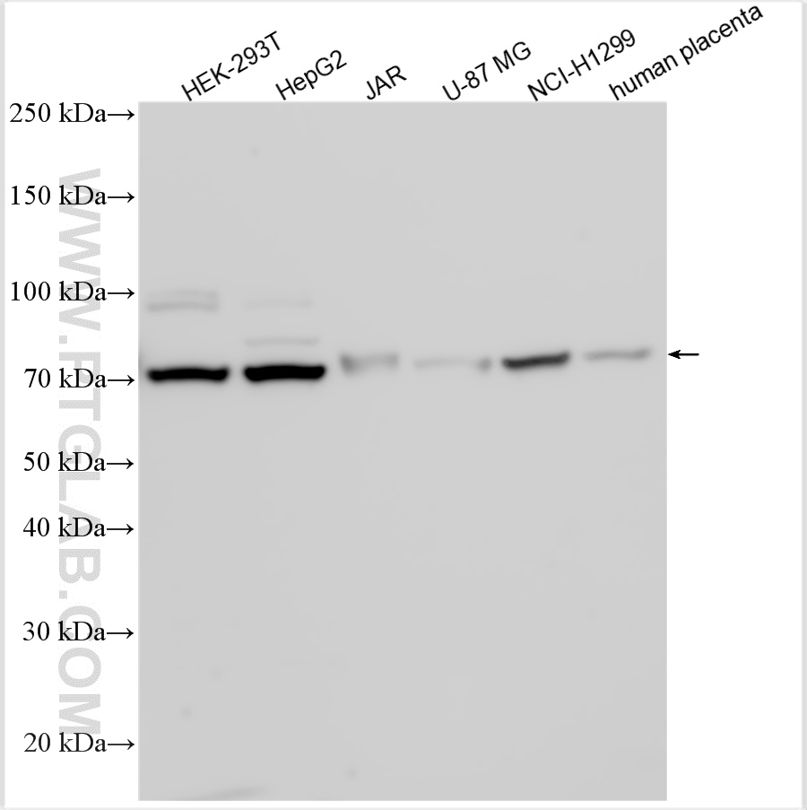 Western Blot (WB) analysis of various lysates using HGF Polyclonal antibody (26881-1-AP)