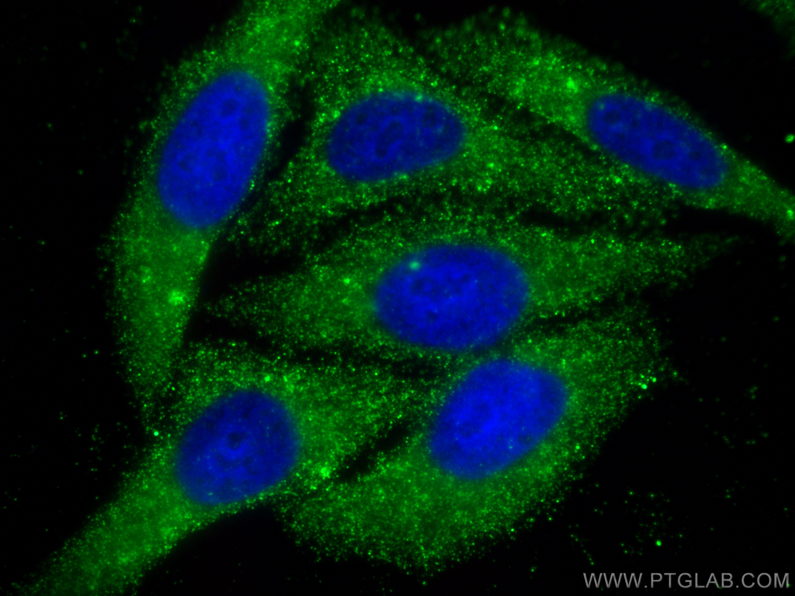 Immunofluorescence (IF) / fluorescent staining of HepG2 cells using HGS Monoclonal antibody (67818-1-Ig)