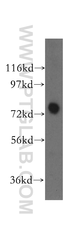 Western Blot (WB) analysis of HEK-293 cells using HHIP Polyclonal antibody (11654-1-AP)