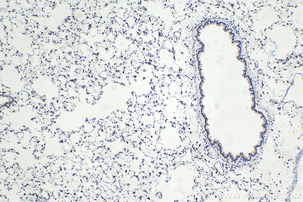 Immunohistochemistry (IHC) staining of rat lung tissue using HIC1 Polyclonal antibody (24949-1-AP)