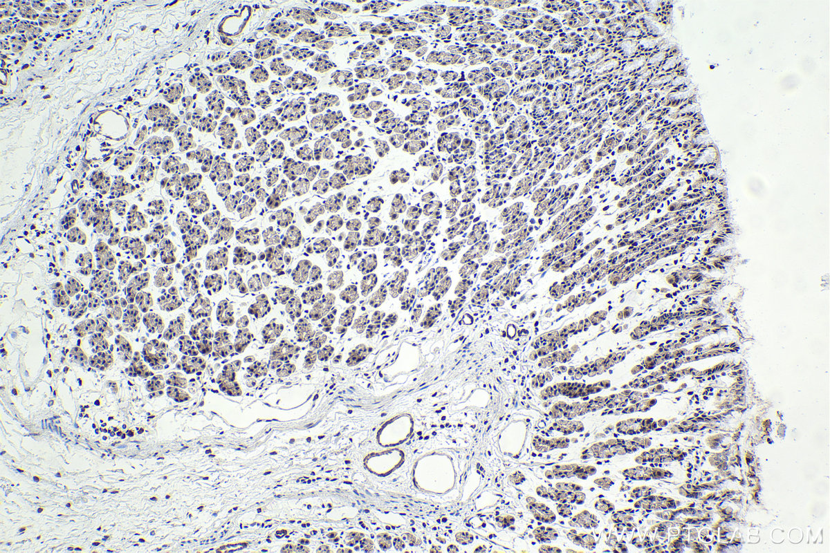 Immunohistochemistry (IHC) staining of rat stomach tissue using HIC1 Polyclonal antibody (24949-1-AP)