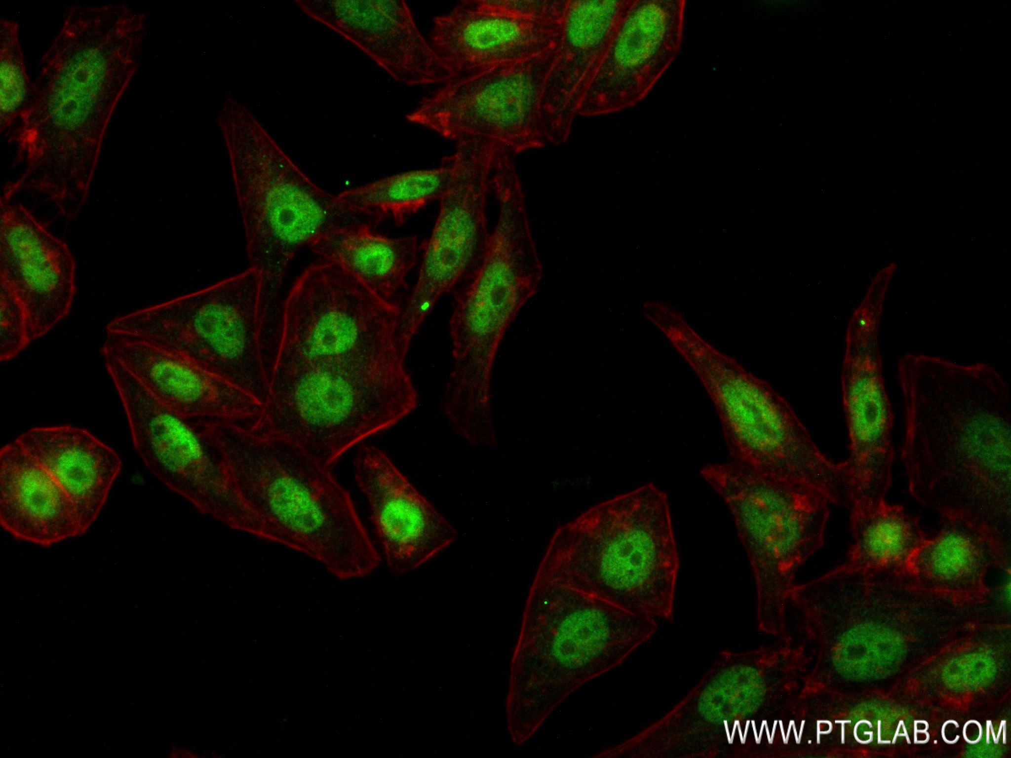 Immunofluorescence (IF) / fluorescent staining of HepG2 cells using HIC2 Recombinant antibody (83162-7-RR)