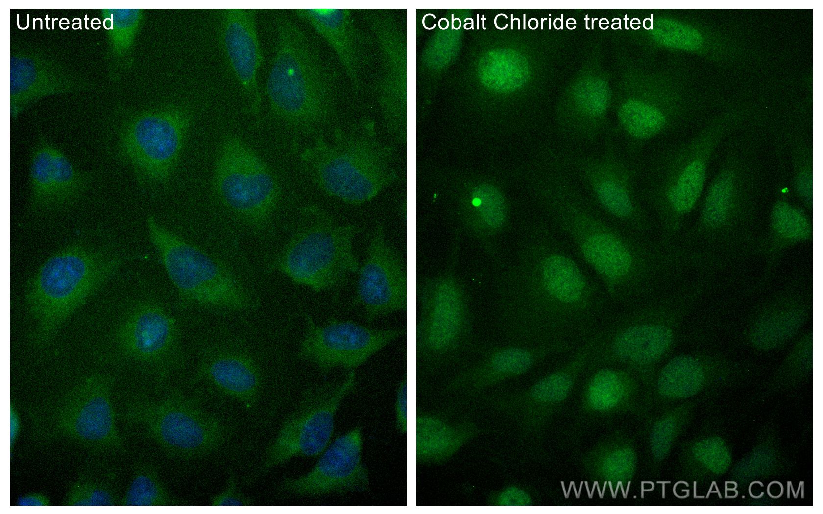 Immunofluorescence (IF) / fluorescent staining of HeLa cells using FITC Plus-conjugated HIF-1 alpha Polyclonal antibo (FITC-20960)