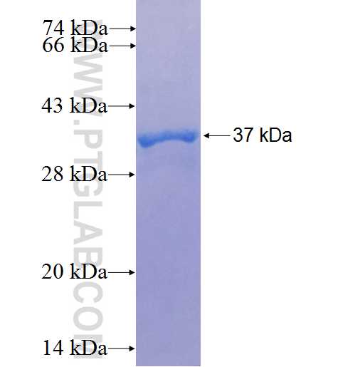 HIF1AN fusion protein Ag25425 SDS-PAGE