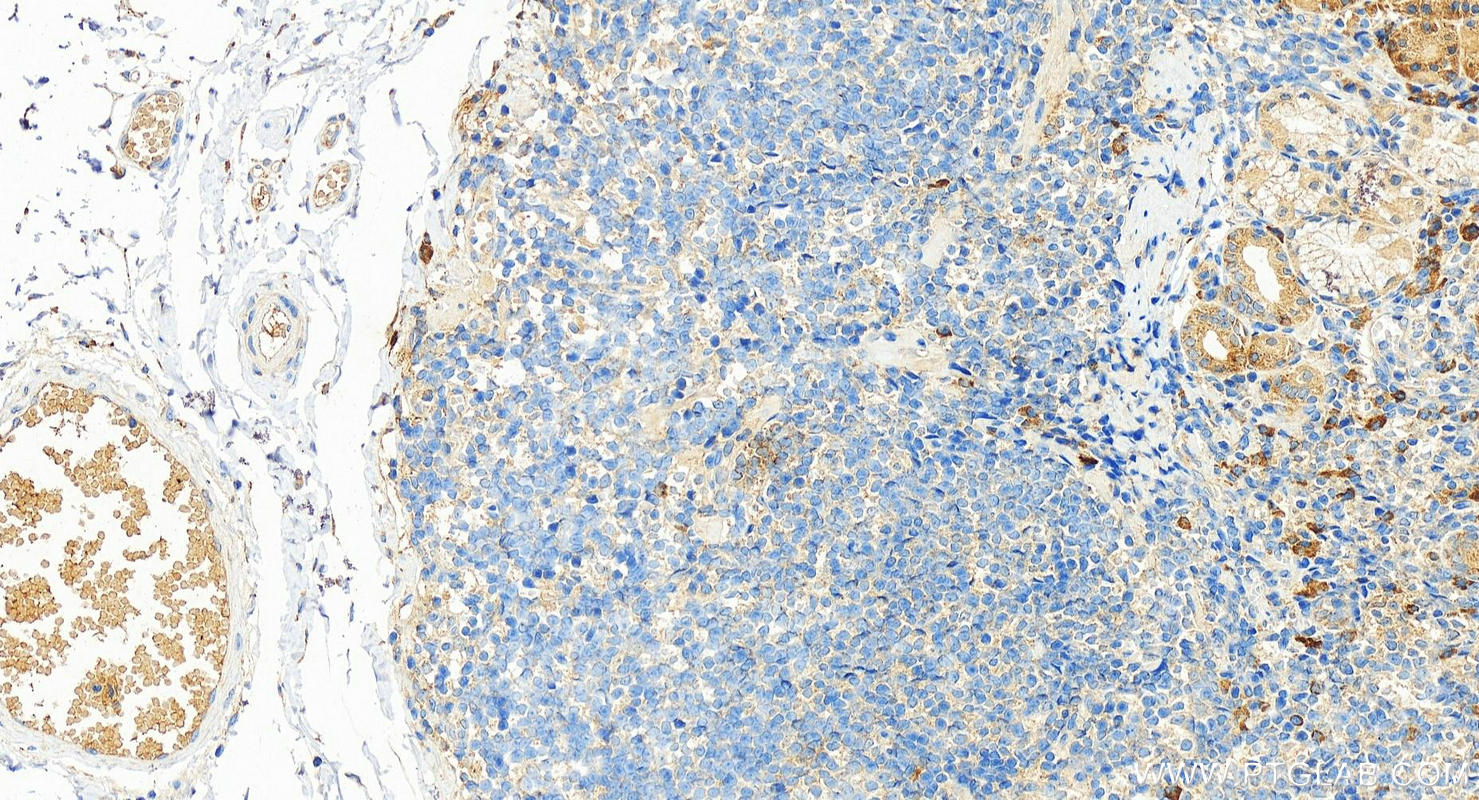 Immunohistochemistry (IHC) staining of human stomach tissue using HIF-1 alpha Recombinant antibody (80933-1-RR)