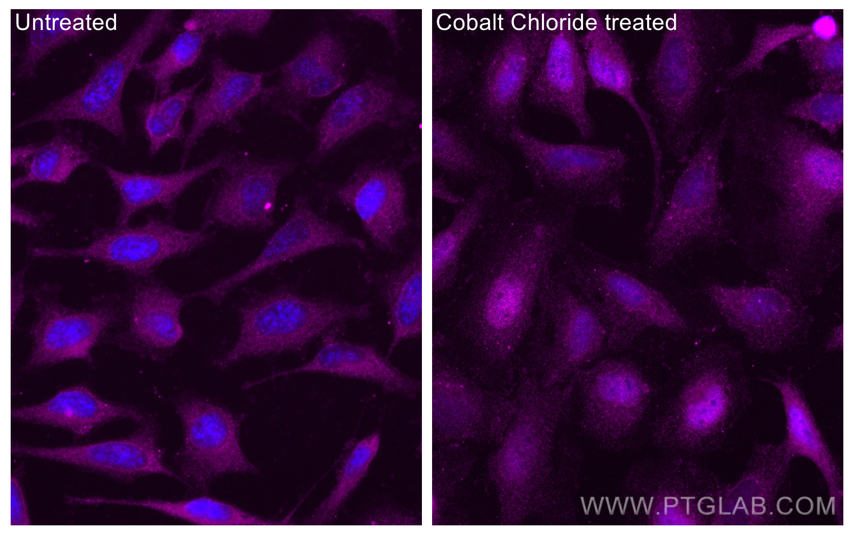 Immunofluorescence (IF) / fluorescent staining of HeLa cells using CoraLite® Plus 647-conjugated HIF-1 alpha Polyclon (CL647-20960)