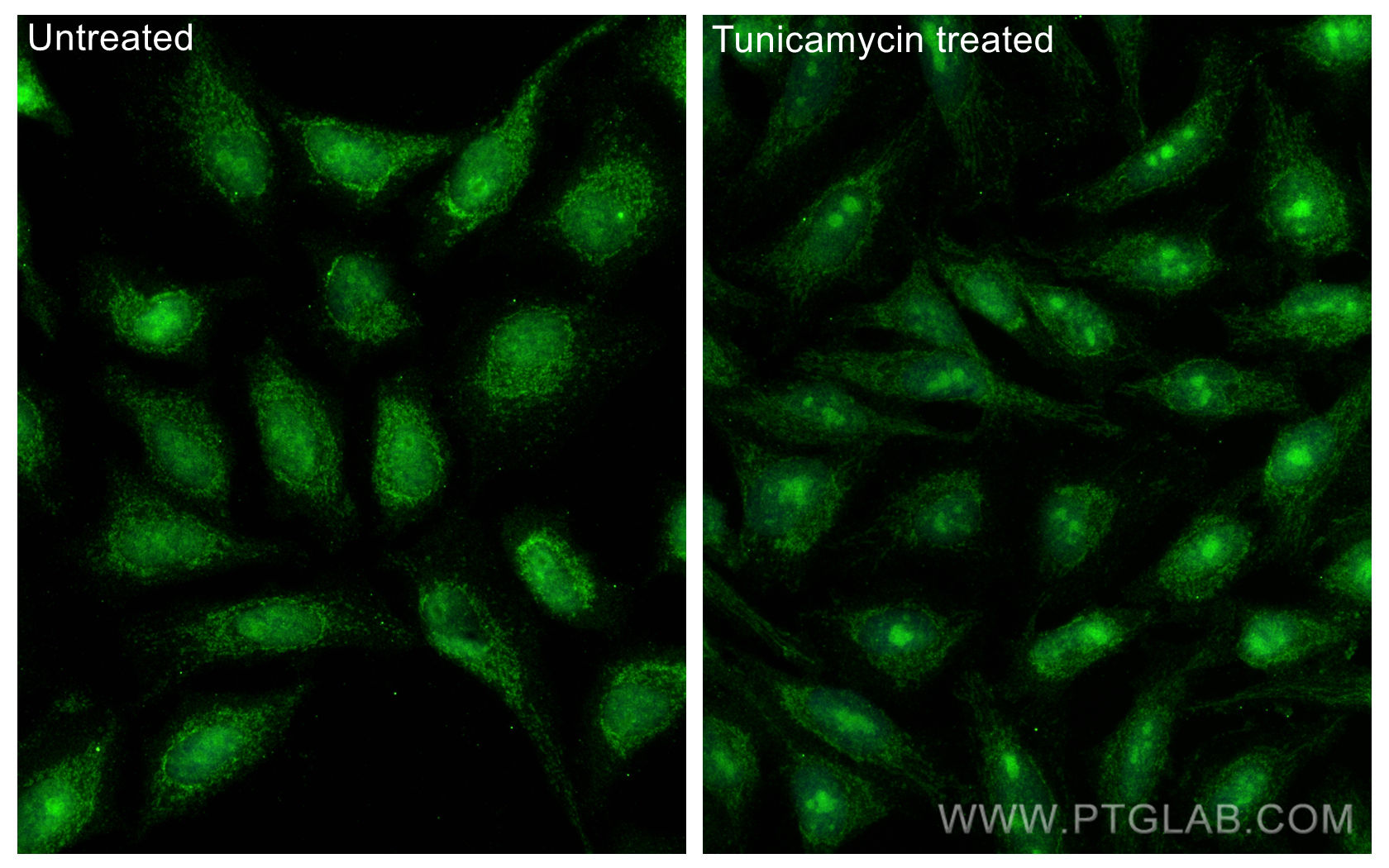 Immunofluorescence (IF) / fluorescent staining of HeLa cells using HIF3A Polyclonal antibody (27650-1-AP)