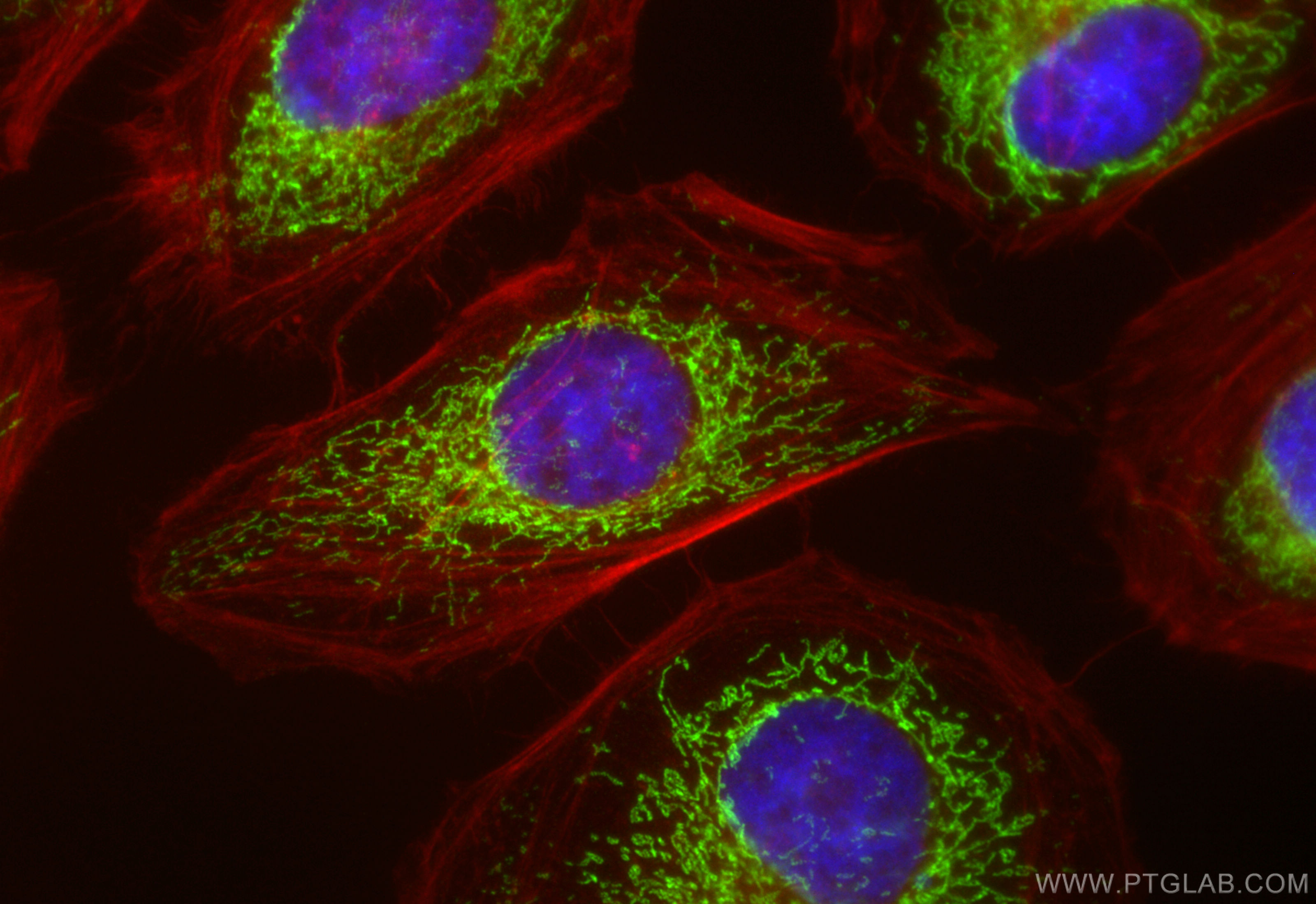 Immunofluorescence (IF) / fluorescent staining of HeLa cells using HINT2 Recombinant antibody (84031-5-RR)