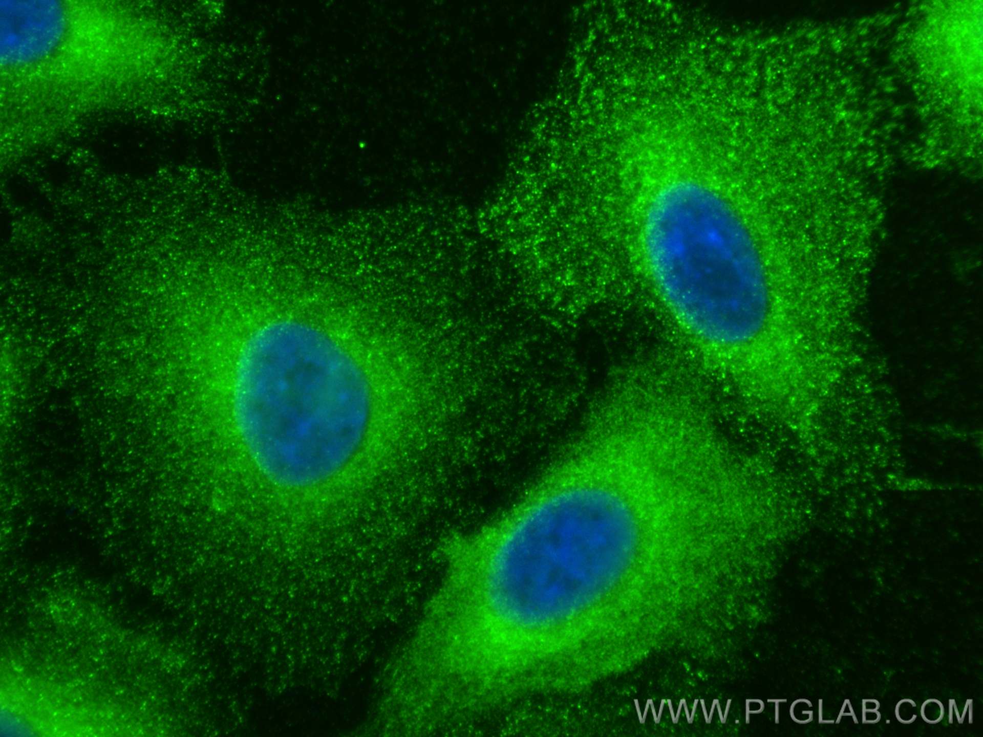 Immunofluorescence (IF) / fluorescent staining of A549 cells using HIP1 Polyclonal antibody (22231-1-AP)