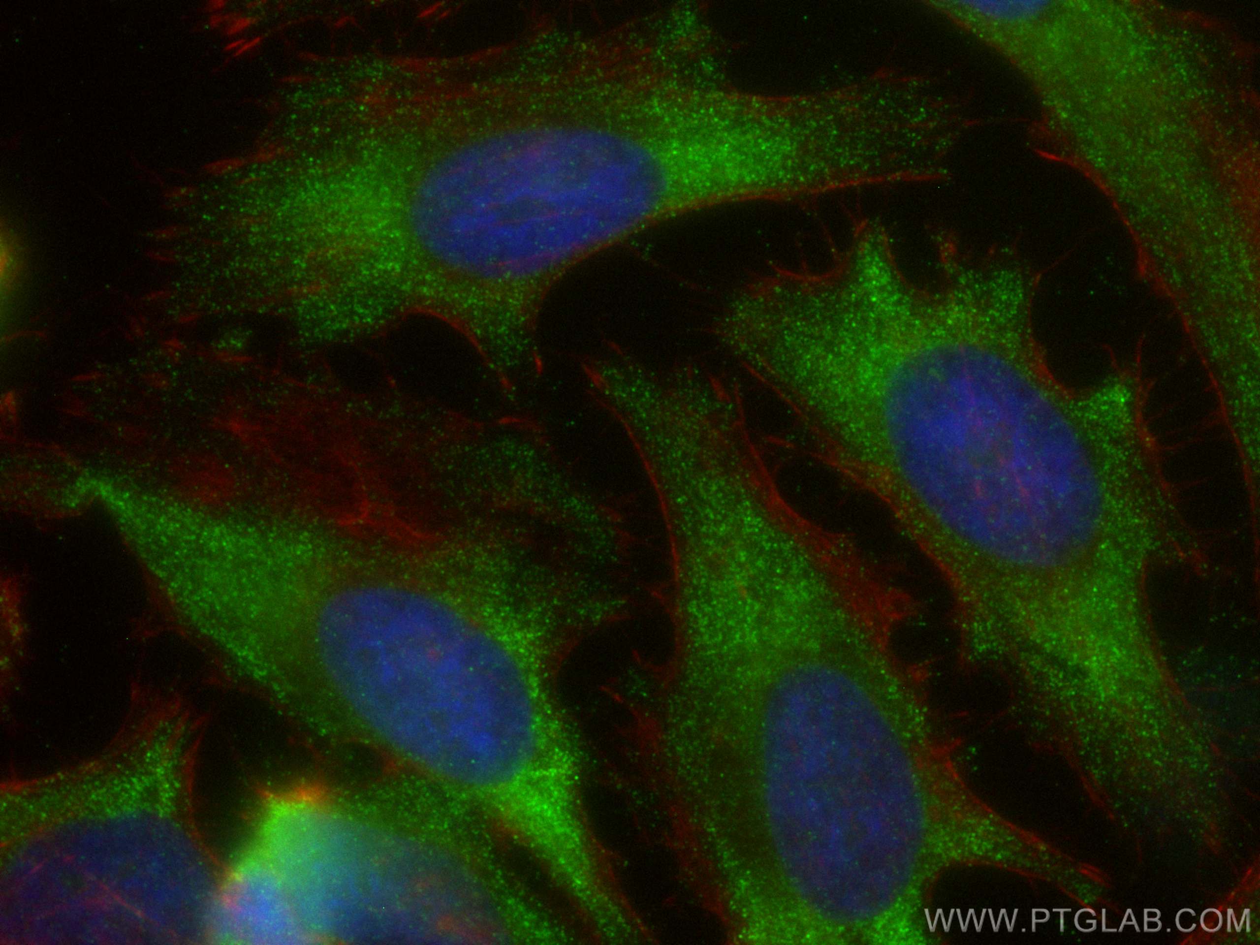 Immunofluorescence (IF) / fluorescent staining of HeLa cells using HIP1R Monoclonal antibody (68403-1-Ig)